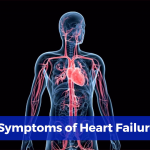 Signs Of Heart Failure
