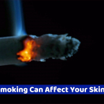 Your Skin Gets Ruined When You Smoke