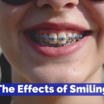 The Facts On Smiling