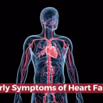 Knowledge On Heart Failure
